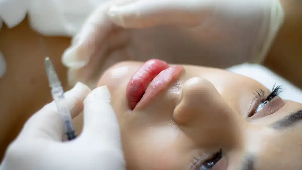 Médecin esthétique effectuant une injection d'acide hyaluronique pour restaurer le volume du visage