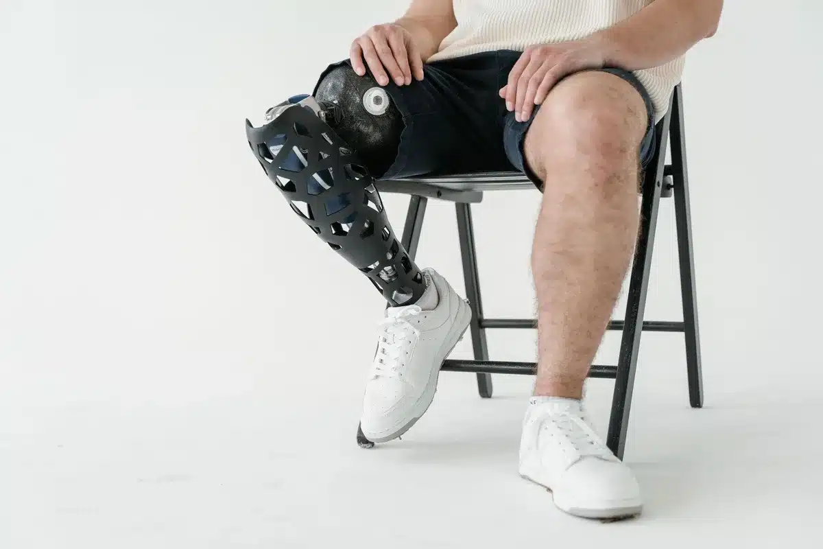 Différents types de stimulateurs circulatoires : manchon de compression, appareil de massage et électrostimulation.